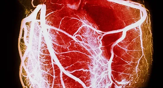 coronary angiography